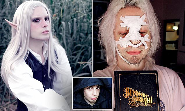 PICS BY LUIS PADRON / CATERS NEWS - (PICTURED: Luis has had 35kUSD in surgery and cosmetic procedures so far, including a jowl op, nose job, fillers and many more - he also has a 5kUSD ritual every month to keep him looking like an elf) - A fantasy fanatic has spent over USD35,000 on plastic surgery including laser skin bleaching and to become a REAL-LIFE ELF. Luis Padron, 25, from Buenos Ares, Argentina, became obsessed with the world of elves, angels and fantasy beings after being bullied as a child. He became determined to look like his favourite otherworldly characters and sourced inspiration from films including Labyrinth and The NeverEnding Story. To look more like an elf, Luis started bleaching his hair and skin and now he has a USD5,000-a-month ritual applying specialist creams, dyes, treatment and SPF100 sunscreen. Additionally, hes splashed over USD35,000 on surgery including liposuction on his jaw, a rhinoplasty, full body hair removal and operations to change his eye colour. Luis gets stared at for his unusual look but says he doesnt care what people think and that he wont stop until he has fully transformed into an elf. Hes planning surgery to make his ears pointed, hair implants for a heart-shaped hairline and a limb lengthening op to make him 6ft 5. - SEE CATERS COPY