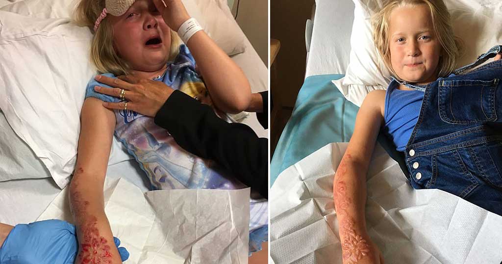 7χρονη έπαθε σοβαρό έγκαυμα από τατουάζ- χένα: Προειδοποιεί το υπουργείο Υγείας (pics)