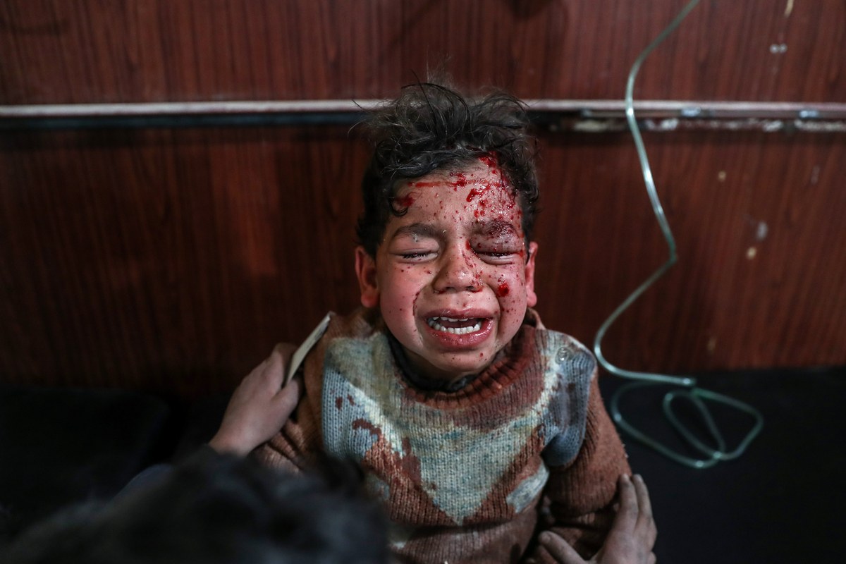 Η φρίκη του πολέμου: Παιδιά κοιτούν τα κομμένα πόδια τους και κλαίνε – Εντελώς μόνα