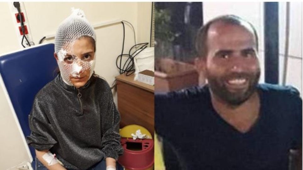 Τούρκος επιτέθηκε με μαχαίρι σε 31χρονη – Απέρριψε τις σεξουαλικές προτάσεις του