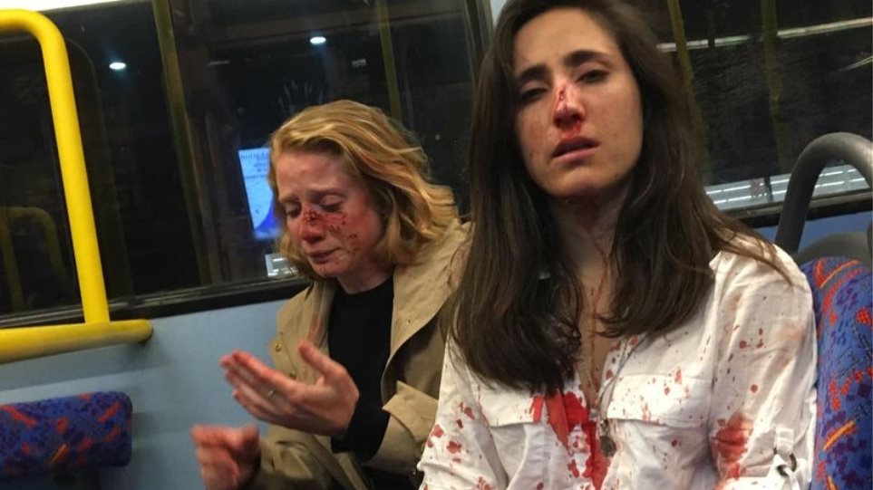 Λονδίνο – Επίθεση: Ξυλοκόπησαν αεροσυνοδό και την κοπέλα της αφού αρνήθηκαν να φιληθούν
