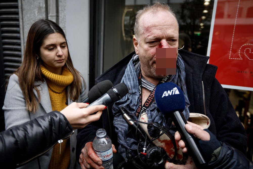 Επίθεση σε δημοσιογράφο – Σύνταγμα: Καταδικάζει ο Πέτσας