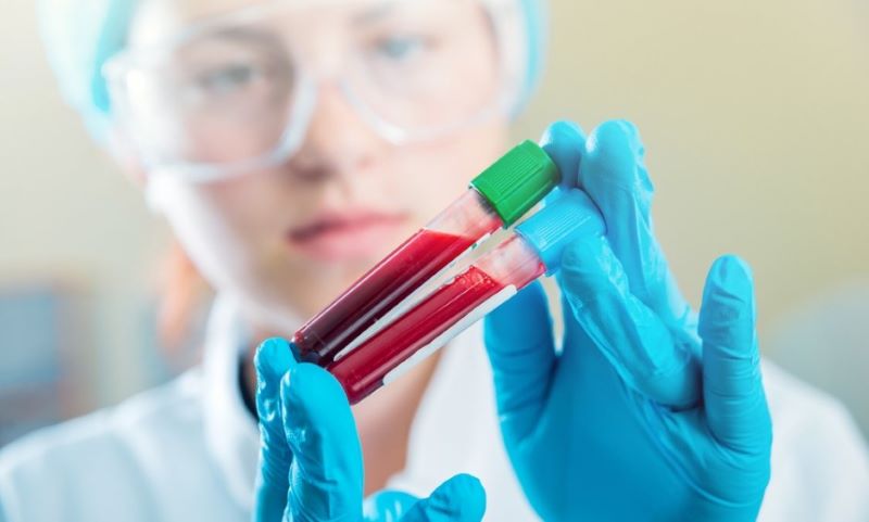 Καρκίνος τεστ αίματος: Νέα επαναστατική μέθοδος ανίχνευσης