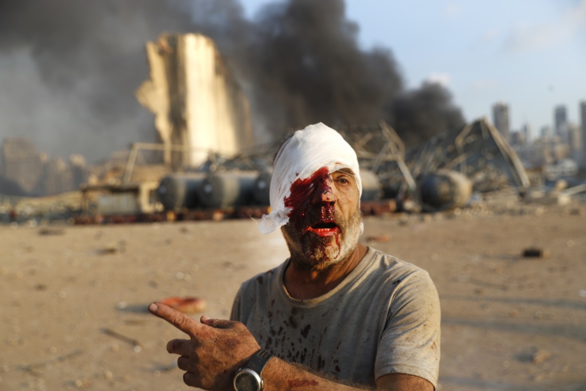 Λίβανος – Βηρυτός έκρηξη: «Είναι αμέλεια», δηλώνουν οι Αρχές