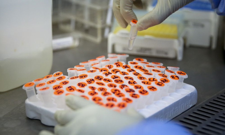 Κύπρος κορονοϊός εταιρεία: Δύο κρούσματα του φονικού ιού στην NIPD Genetics