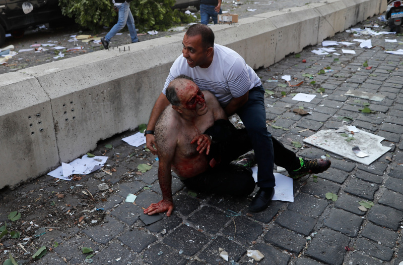Λίβανος – Βηρυτός έκρηξη: Αυξάνονται δραματικά οι νεκροί, εικόνες πολέμου