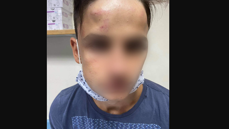 Ξυλοδαρμός 17χρονου Γαλάτσι: Τον χτυπούσαν 20 άτομα με μανία επί 10 λεπτά