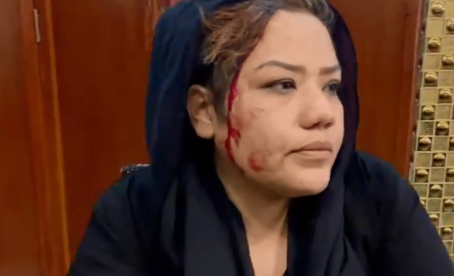 Γυναίκες στην Καμπούλ: Με ακάλυπτα πρόσωπα, συγκρούστηκαν με οπλισμένους Ταλιμπάν