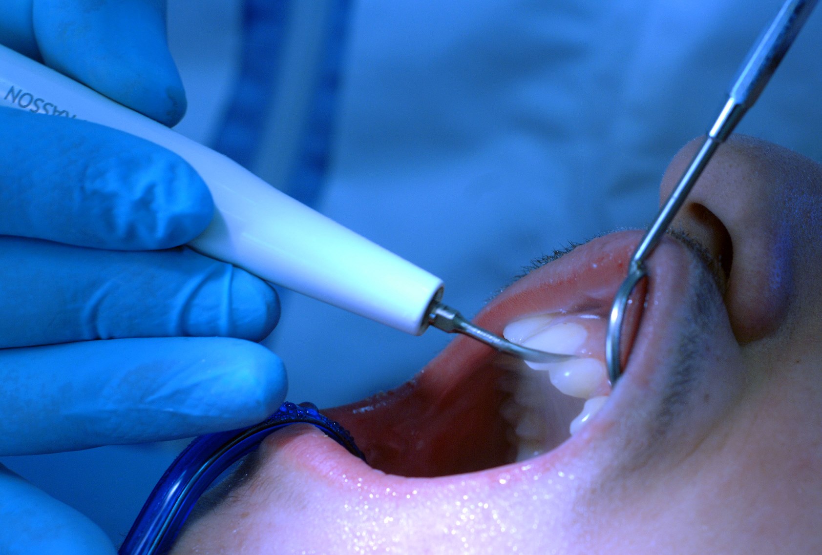 Οδοντίατρος rapid test: Νέα ΚΥΑ αναμένεται