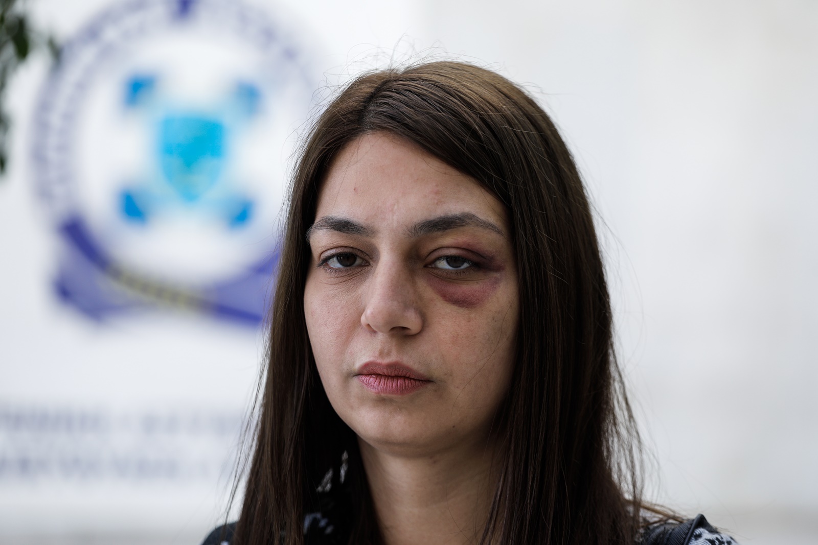 Μαρία Απατζίδη ΜΑΤ: Ξυλοδαρμό καταγγέλλει η βουλευτής του ΜέΡΑ25