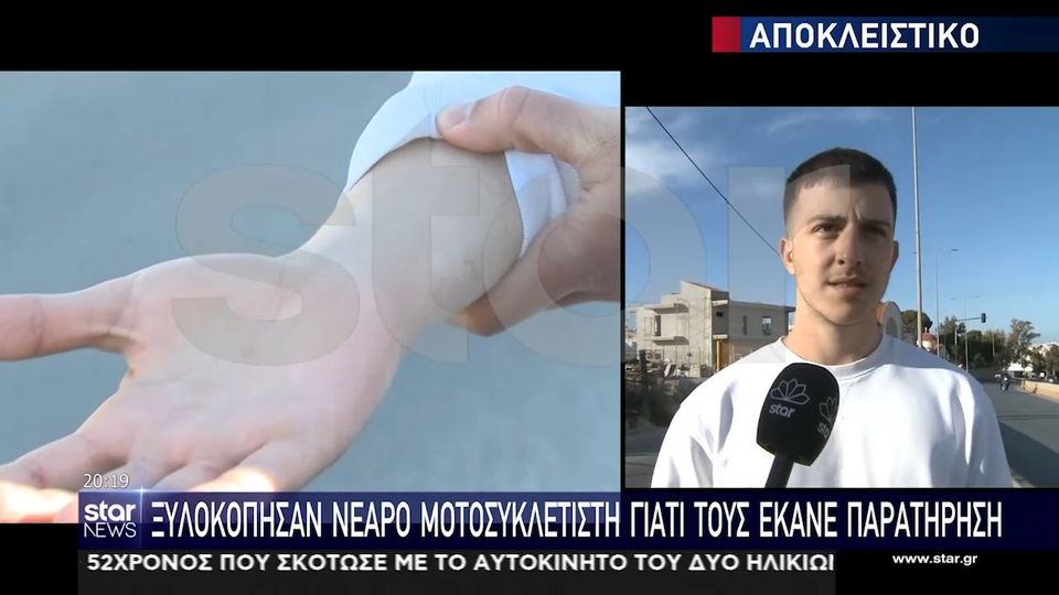 Ξυλοδαρμός μοτοσικλετιστή – Ηράκλειο: «Αν δεν φορούσα κράνος θα με είχαν σκοτώσει στο ξύλο»