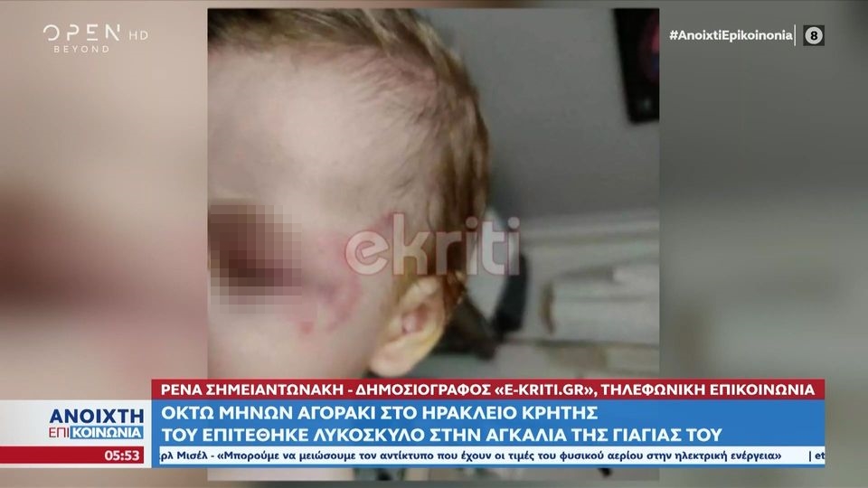 Επίθεση σκύλου σε μωρό – Κρήτη: Συγκλονίζει με την περιγραφή του ο πατέρας του βρέφους