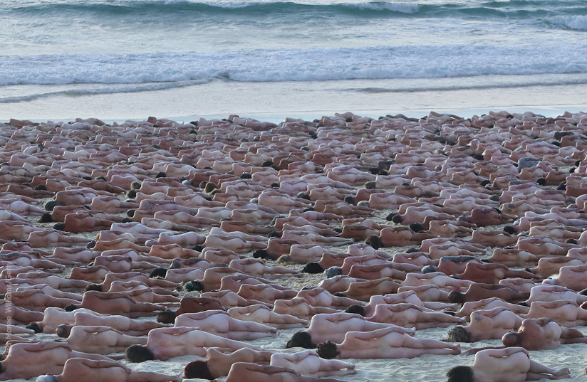 Καρκίνος του δέρματος: Συγκλονιστική γυμνή φωτογράφιση στην Αυστραλία